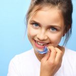 14 most important questions about braces