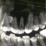 3D снимок зубов - что это