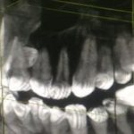 3D image of teeth - what is it?