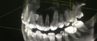 3D image of teeth - what is it?