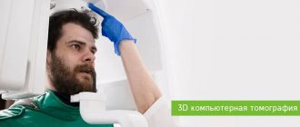 3D dental tomography