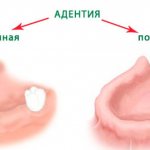 Адентия