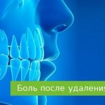 pain after wisdom tooth removal