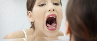 Oral cavity hurts