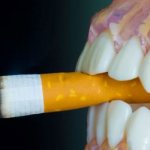 what happens if you smoke while getting a tooth implant?