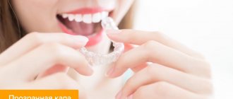 Photo of a girl putting transparent aligners on her teeth