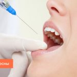 Photo of an injection into the gum for periodontal disease