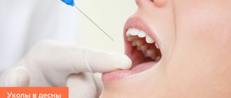 Photo of an injection into the gum for periodontal disease