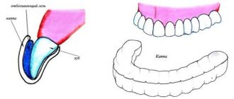 Teeth whitening gels and trays