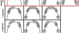 Classification of dentition defects according to Kennedy. Orthopedics 