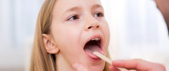 treatment of chronic tonsillitis