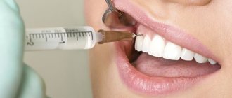 dental treatment for a nursing mother