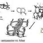 лигатурное связывание по Айви