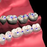 Fundamentals of occlusion and biomechanics of the jaws: a new look at old concepts