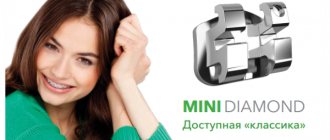 Показания к установке брекетов Mini Diamond