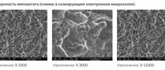 поверхность имплантов Альфа био