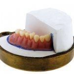 Применение быстротвердеющей пластмассы в стоматологии