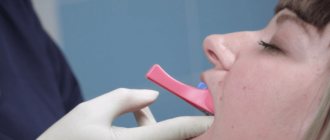 Процесс снятия слепков зубов для изготовления элайнеров