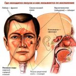 Проявления синуситов (воспаление придаточных пазух носа).jpg