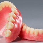 Removable dentures: which ones are better?