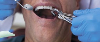 How long does anesthesia wear off after tooth extraction - Line of Smile Dentistry