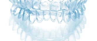 How much do clear aligners cost?
