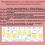 Black&#39;s stages of caries