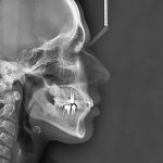 Teleradiography in dentistry