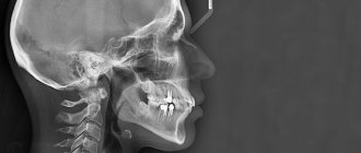 Teleradiography in dentistry