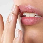 Lip care after augmentation