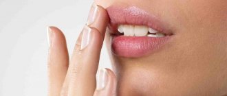 Lip care after augmentation