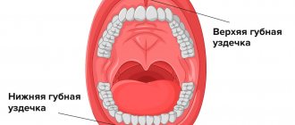 Frenules of the upper and lower lips in pictures