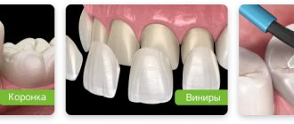 варианты восстановления разрушенного зуба