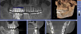 Важным элементом в обследовании является 3D моделирование