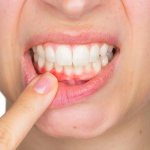 Tooth root inflammation: causes, symptoms and treatment