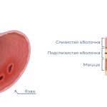 Inflamed ulcer and cross-sectional diagram of the gastric mucosa