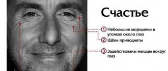 TENSION zones of the face: WHAT is connected with them